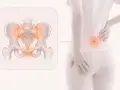Illustration visar bäckenet med markerad smärta, som kan upplevas som ont i blygdbenet gravid.