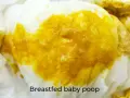 Close-up of bright yellow, seedy breastfed baby poop on a white diaper.