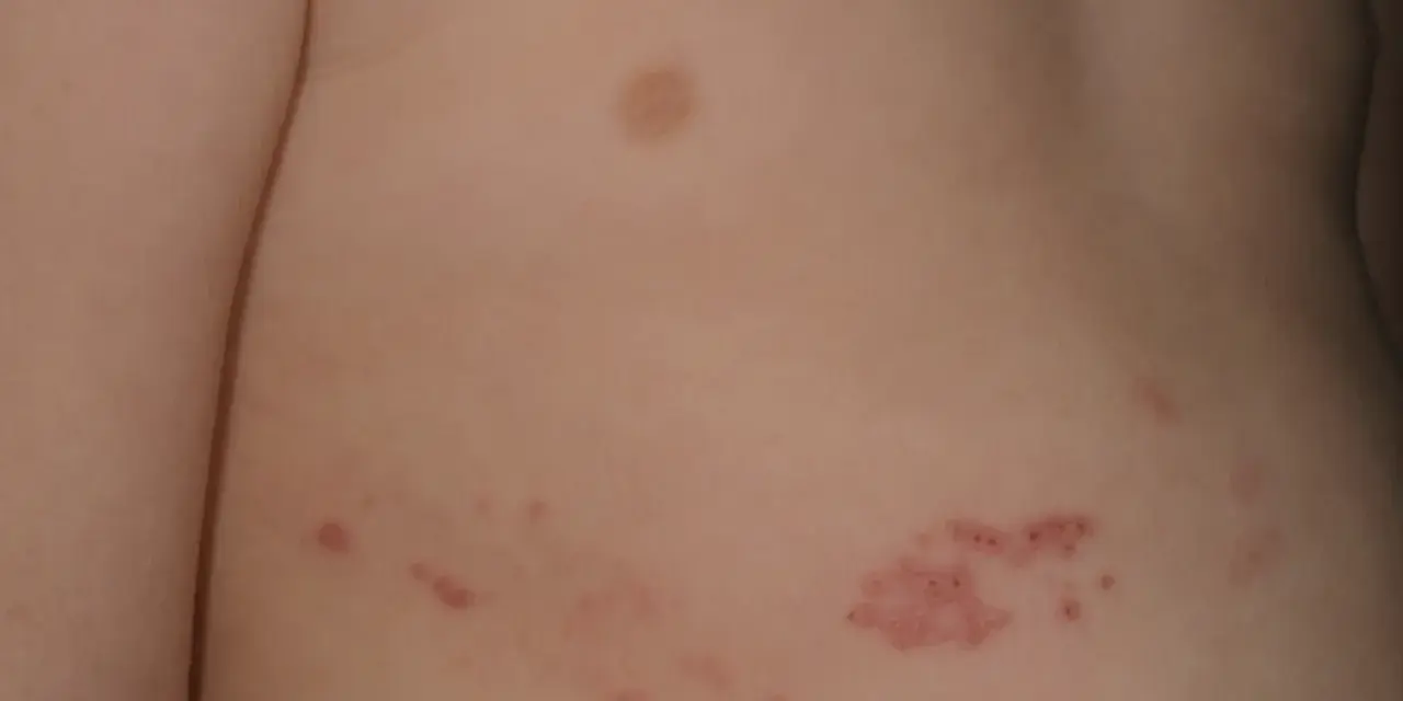Barnets hud visar röda utslag och blåsor, typiska virusprickar hos barn.