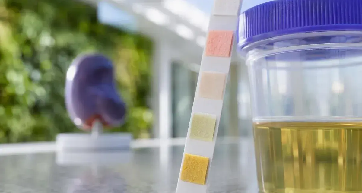 Urinprov med teststicka och mugg. En modell av en njure syns i bakgrunden, relevant för att undersöka protein i urin gravid.