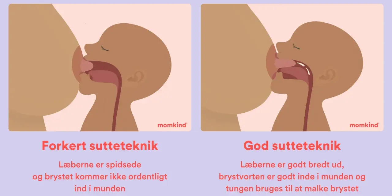 Illustrationer visar amningsteknik. Till vänster, fel teknik med spetsade läppar och kort tungband. Till höger, bra teknik med breda läppar och tungan som mjölkar bröstet.