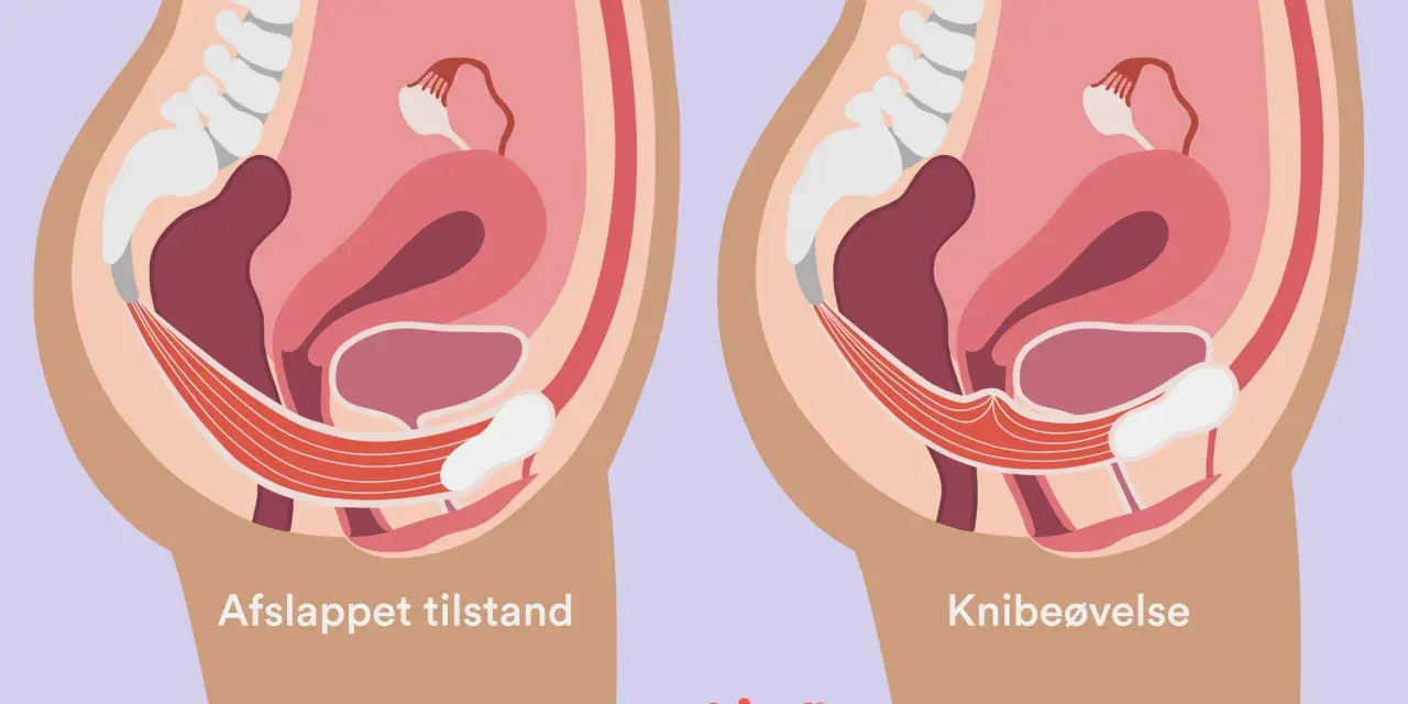 Illustration av bäckenbotten i avslappnat tillstånd och vid knipövning. Kan hjälpa vid tryck neråt och ont i blygdbenet.