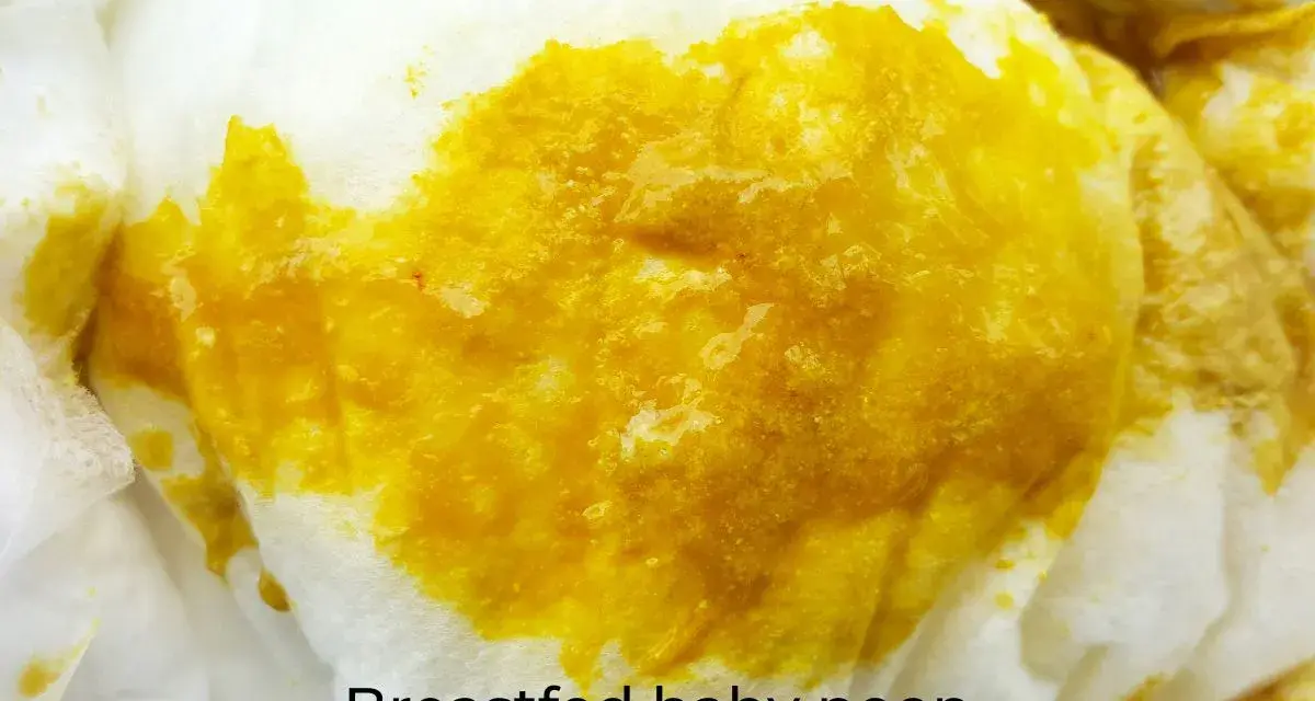 Close-up of bright yellow, seedy breastfed baby poop on a white diaper.