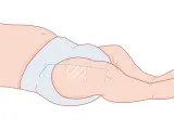 Illustration av ett barns ben och blöja, visar var vaccin ges vid 3 månader.