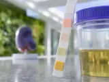 Urinprov med teststicka och mugg. En modell av en njure syns i bakgrunden, relevant för att undersöka protein i urin gravid.
