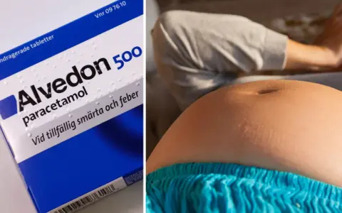 Alvedon 500 mg för smärta och feber. En gravid kvinna funderar på alvedon gravid hur ofta hon kan ta det.