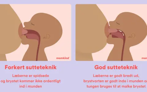 Illustrationer visar amningsteknik. Till vänster, fel teknik med spetsade läppar och kort tungband. Till höger, bra teknik med breda läppar och tungan som mjölkar bröstet.