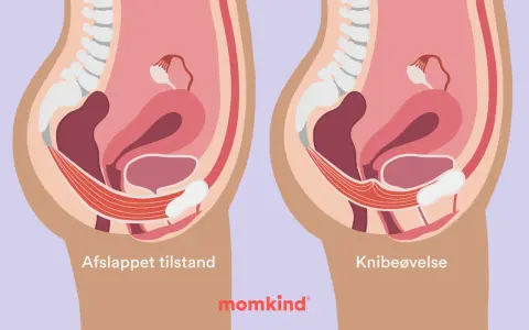 Illustration av bäckenbotten i avslappnat tillstånd och vid knipövning. Kan hjälpa vid tryck neråt och ont i blygdbenet.