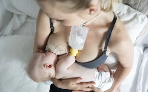 En mamma matar sitt barn med en flaska som är fäst vid bröstet, med hjälp av ett bröstvårtsskydd för att underlätta amningen.