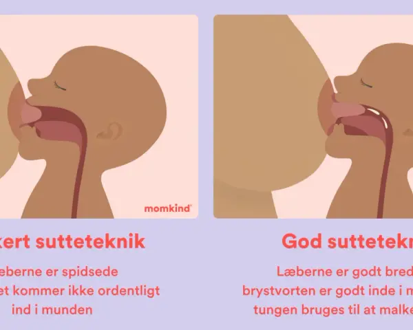 Illustrationer visar amningsteknik. Till vänster, fel teknik med spetsade läppar och kort tungband. Till höger, bra teknik med breda läppar och tungan som mjölkar bröstet.