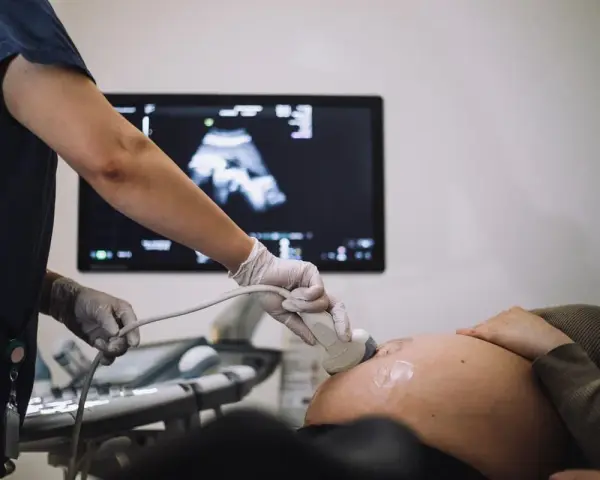 Gravid kvinna får ultraljud. Läkaren undersöker fostret, 18 veckor, på skärmen.