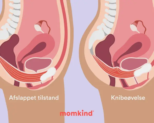Illustration av bäckenbotten i avslappnat tillstånd och vid knipövning. Kan hjälpa vid tryck neråt och ont i blygdbenet.