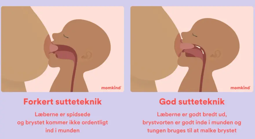 Illustrationer visar amningsteknik. Till vänster, fel teknik med spetsade läppar och kort tungband. Till höger, bra teknik med breda läppar och tungan som mjölkar bröstet.