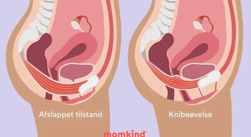 Illustration av bäckenbotten i avslappnat tillstånd och vid knipövning. Kan hjälpa vid tryck neråt och ont i blygdbenet.