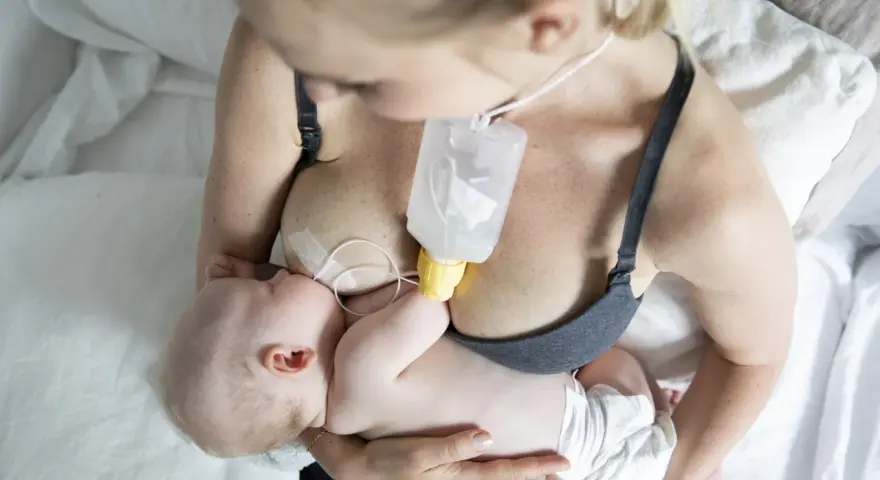 En mamma matar sitt barn med en flaska som är fäst vid bröstet, med hjälp av ett bröstvårtsskydd för att underlätta amningen.