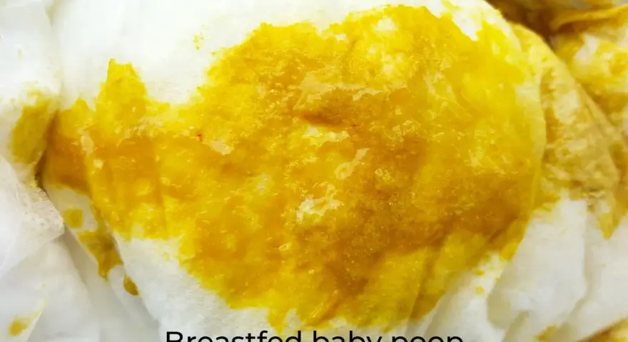 Close-up of bright yellow, seedy breastfed baby poop on a white diaper.